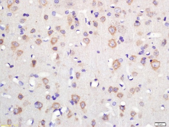 Immunohistochemistry (Formalin/PFA-fixed paraffin-embedded sections) - Anti-TSPAN12 antibody (AB213678), expandable thumbnail