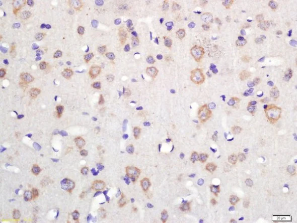 Immunohistochemistry (Formalin/PFA-fixed paraffin-embedded sections) - Anti-TSPAN12 antibody (AB213678)