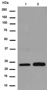 Western blot - Anti-TSPAN31 + Tspan-13 antibody [EPR11225(2)] (AB180502)