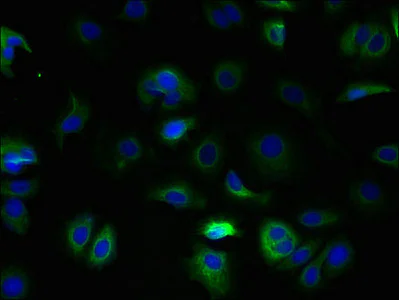 Immunocytochemistry/ Immunofluorescence - Anti-TSPAN5 antibody (AB236881)