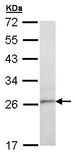 Western blot - Anti-TSPAN6 antibody (AB137637)