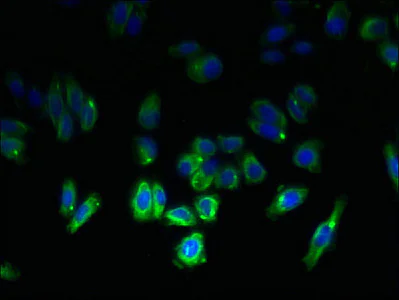 Immunocytochemistry/ Immunofluorescence - Anti-TSPAN6 antibody (AB236883)