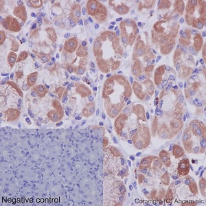 Immunohistochemistry (Formalin/PFA-fixed paraffin-embedded sections) - Anti-TSPEAR antibody [EPR15505] (AB192023), expandable thumbnail