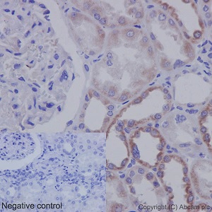 Immunohistochemistry (Formalin/PFA-fixed paraffin-embedded sections) - Anti-TSPEAR antibody [EPR15505] (AB192023), expandable thumbnail