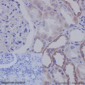 Immunohistochemistry (Formalin/PFA-fixed paraffin-embedded sections) - Anti-TSPEAR antibody [EPR15505] (AB192023)