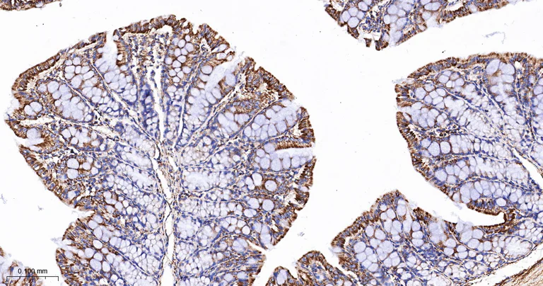 Immunohistochemistry (Formalin/PFA-fixed paraffin-embedded sections) - Anti-TSPO antibody [12B8] (AB326712)