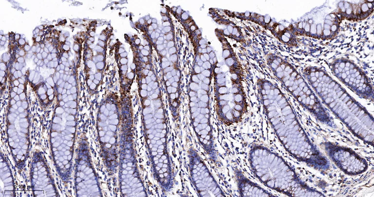 Immunohistochemistry (Formalin/PFA-fixed paraffin-embedded sections) - Anti-TSPO antibody [12B8] (AB326712)