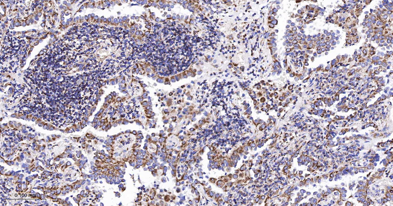 Immunohistochemistry (Formalin/PFA-fixed paraffin-embedded sections) - Anti-TSPO antibody [12B8] (AB326712)