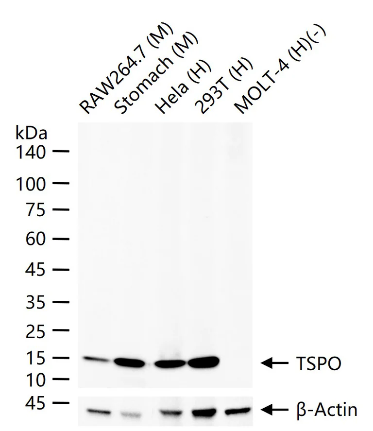 Western blot - Anti-TSPO antibody [12B8] (AB326712)