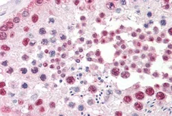 Immunohistochemistry (Formalin/PFA-fixed paraffin-embedded sections) - Anti-TSPY1/TSPY antibody - C-terminal (AB189962)