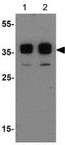 Western blot - Anti-TSPY1/TSPY antibody - C-terminal (AB189962)