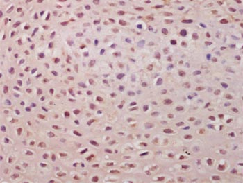 Immunohistochemistry (Formalin/PFA-fixed paraffin-embedded sections) - Anti-TSPYL5 antibody (AB203657), expandable thumbnail