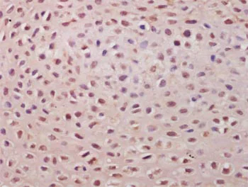 Immunohistochemistry (Formalin/PFA-fixed paraffin-embedded sections) - Anti-TSPYL5 antibody (AB203657)