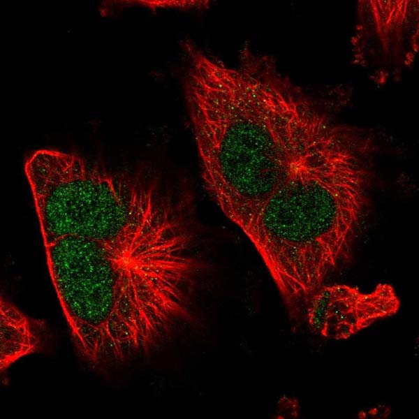 Immunocytochemistry/ Immunofluorescence - Anti-TSR1 antibody (AB220639), expandable thumbnail