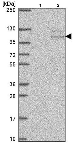 Western blot - Anti-TSR1 antibody (AB220639), expandable thumbnail