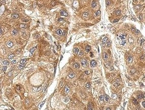 Immunohistochemistry (Formalin/PFA-fixed paraffin-embedded sections) - Anti-TSR2 antibody (AB155810), expandable thumbnail