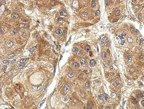 Immunohistochemistry (Formalin/PFA-fixed paraffin-embedded sections) - Anti-TSR2 antibody (AB155810)