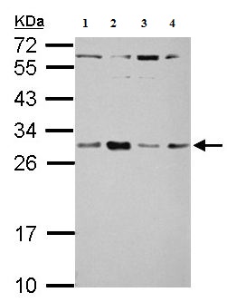 Western blot - Anti-TSR2 antibody (AB155810), expandable thumbnail