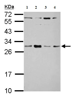 Western blot - Anti-TSR2 antibody (AB155810)