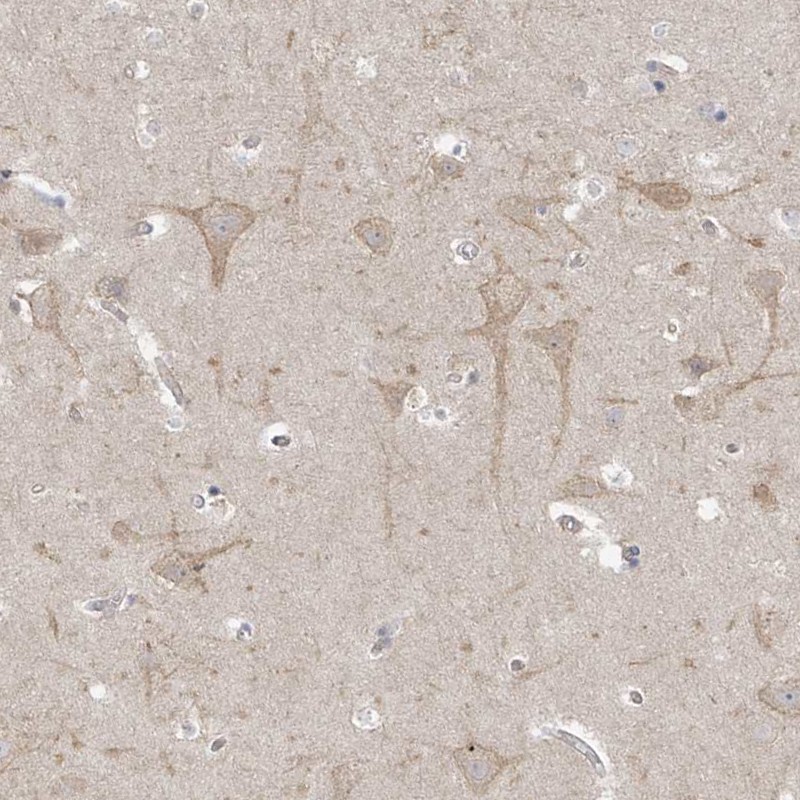 Immunohistochemistry (Formalin/PFA-fixed paraffin-embedded sections) - Anti-TSSC1 antibody (AB251813)