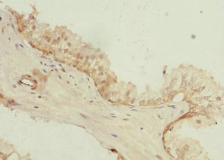 Immunohistochemistry (Formalin/PFA-fixed paraffin-embedded sections) - Anti-TSSC3 antibody (AB234669)
