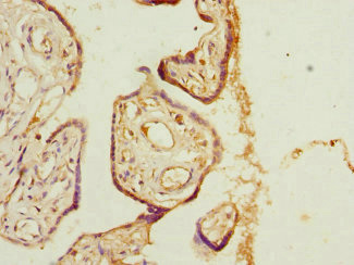 Immunohistochemistry (Formalin/PFA-fixed paraffin-embedded sections) - Anti-TSSC3 antibody (AB234669)