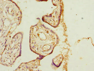 Immunohistochemistry (Formalin/PFA-fixed paraffin-embedded sections) - Anti-TSSC3 antibody (AB234669)