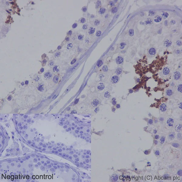 Immunohistochemistry (Formalin/PFA-fixed paraffin-embedded sections) - Anti-TSSK2 antibody [EPR16116] (AB192026)