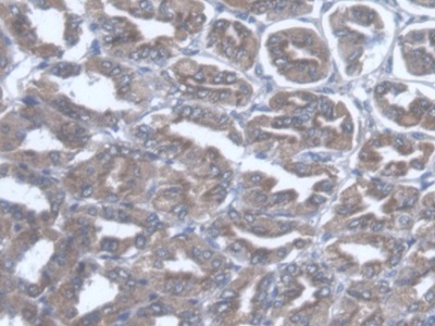 Immunohistochemistry (Formalin/PFA-fixed paraffin-embedded sections) - Anti-TST antibody (AB231248)