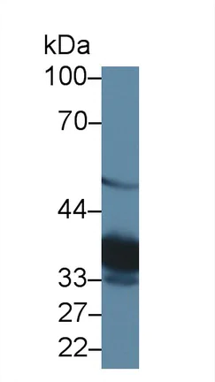 Western blot - Anti-TST antibody (AB231248)