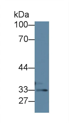 Western blot - Anti-TST antibody (AB231248)