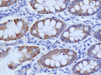 Immunohistochemistry (Formalin/PFA-fixed paraffin-embedded sections) - Anti-TST antibody [EPR11645(B)] (AB168359)