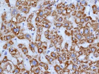 Immunohistochemistry (Formalin/PFA-fixed paraffin-embedded sections) - Anti-TST antibody [EPR11645(B)] (AB168359)