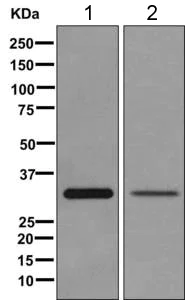 Western blot - Anti-TST antibody [EPR11645(B)] (AB168359)
