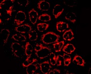 Immunocytochemistry/ Immunofluorescence - Anti-TST antibody [EPR11646(B)] (ab166625), expandable thumbnail