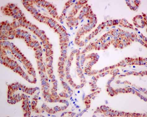 Immunohistochemistry (Formalin/PFA-fixed paraffin-embedded sections) - Anti-TST antibody [EPR11646(B)] (AB166625), expandable thumbnail
