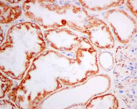 Immunohistochemistry (Formalin/PFA-fixed paraffin-embedded sections) - Anti-TST antibody [EPR11646(B)] (AB166625), expandable thumbnail