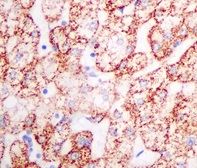 Immunohistochemistry (Formalin/PFA-fixed paraffin-embedded sections) - Anti-TST antibody [EPR11646(B)] (ab166625), expandable thumbnail