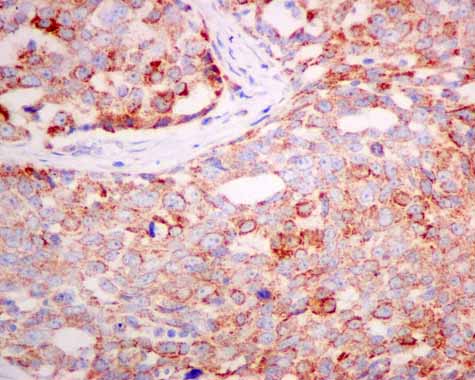 Immunohistochemistry (Formalin/PFA-fixed paraffin-embedded sections) - Anti-TST antibody [EPR11646(B)] (AB166625), expandable thumbnail