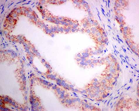 Immunohistochemistry (Formalin/PFA-fixed paraffin-embedded sections) - Anti-TST antibody [EPR11646(B)] (AB166625), expandable thumbnail