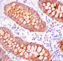 Immunohistochemistry (Formalin/PFA-fixed paraffin-embedded sections) - Anti-TST antibody [EPR11646(B)] (ab166625), expandable thumbnail