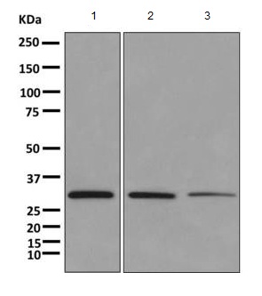 Western blot - Anti-TST antibody [EPR11646(B)] (AB166625), expandable thumbnail