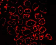 Immunocytochemistry/ Immunofluorescence - Anti-TST antibody [EPR11646(B)] - BSA and Azide free (AB249363)