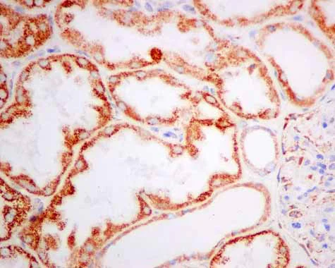 Immunohistochemistry (Formalin/PFA-fixed paraffin-embedded sections) - Anti-TST antibody [EPR11646(B)] - BSA and Azide free (AB249363)