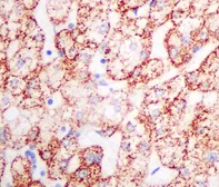 Immunohistochemistry (Formalin/PFA-fixed paraffin-embedded sections) - Anti-TST antibody [EPR11646(B)] - BSA and Azide free (AB249363)