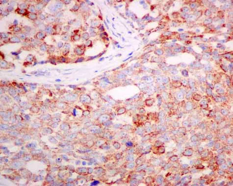 Immunohistochemistry (Formalin/PFA-fixed paraffin-embedded sections) - Anti-TST antibody [EPR11646(B)] - BSA and Azide free (AB249363)