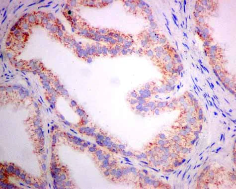 Immunohistochemistry (Formalin/PFA-fixed paraffin-embedded sections) - Anti-TST antibody [EPR11646(B)] - BSA and Azide free (AB249363)