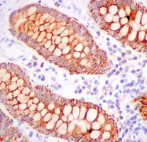 Immunohistochemistry (Formalin/PFA-fixed paraffin-embedded sections) - Anti-TST antibody [EPR11646(B)] - BSA and Azide free (AB249363)