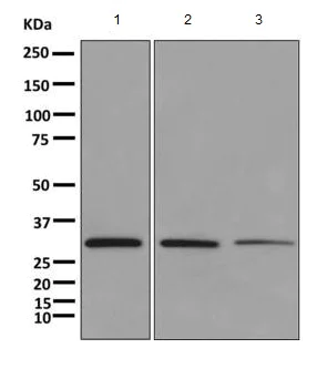 Western blot - Anti-TST antibody [EPR11646(B)] - BSA and Azide free (AB249363)