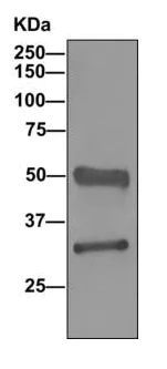 Western blot - Anti-TST antibody [EPR11646(B)] - BSA and Azide free (AB249363)
